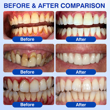 Periodontal & Gum Care Oral Gel